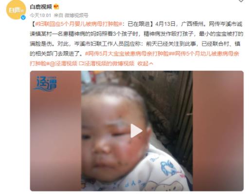 妇联回应5个月婴儿被打肿脸 详情曝光系妈妈精神病发作殴打孩子令人震惊