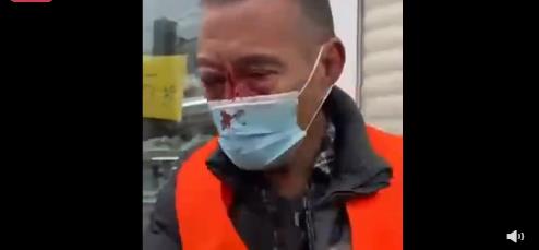68岁环卫工被茶百道员工殴打住院 背后真相曝光老人因收垃圾问题被殴打实在令人气愤