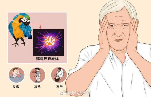 多地出现鹦鹉热患者 专家发声 感染鹦鹉热有哪些症状和表现？