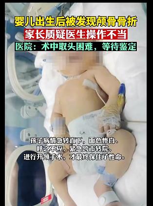 婴儿出生后颅骨骨折 医院回应：因产妇试产时间较长术中取头困难
