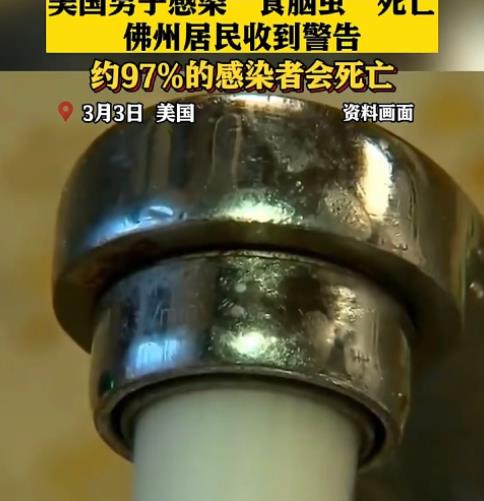 男子用自来水洗脸感染食脑虫死亡 25万居民被警告勿用自来水洗脸