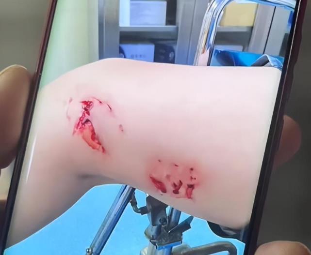 专家称北海伤人鱼类可能是海狼鱼 背后详情曝光有人被咬后缝了20多针